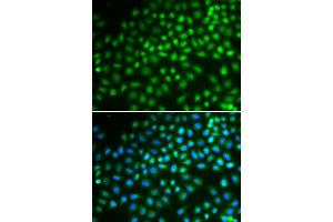 Immunofluorescence (IF) image for anti-SWI/SNF Related, Matrix Associated, Actin Dependent Regulator of Chromatin, Subfamily A, Member 5 (SMARCA5) (AA 100-400) antibody (ABIN3022717) (SMARCA5 抗体  (AA 100-400))