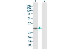 Western Blot analysis of COASY expression in transfected 293T cell line by COASY MaxPab polyclonal antibody. (COASY 抗体  (AA 1-269))
