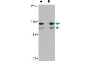 Western blot analysis of SATB1 in SK-N-SH cell lysate with SATB1 polyclonal antibody  at (A) 1 and (B) 2 ug/mL . (SATB1 抗体  (N-Term))