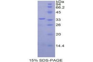 SDS-PAGE analysis of Mouse SPINK5 Protein. (SPINK5 蛋白)