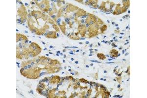 Immunohistochemistry (Paraffin-embedded Sections) (IHC (p)) image for anti-Phospholipase A2, Group IID (PLA2G2D) antibody (ABIN7011300)