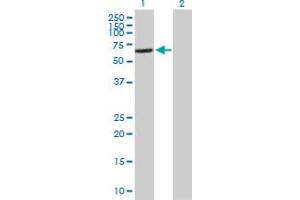 Western Blot analysis of VPS45 expression in transfected 293T cell line by VPS45 MaxPab polyclonal antibody. (VPS45 抗体  (AA 1-570))