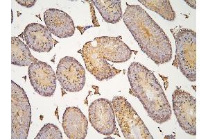 IHC analysis of HOOK3 using anti-HOOK3 antibody (ABIN6719547).