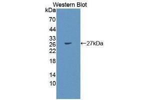 Western blot analysis of the recombinant protein. (PEX1 抗体  (AA 172-377))
