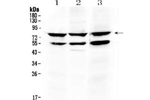 Western blot analysis of RANK using anti- RANK antibody . (TNFRSF11A 抗体  (Middle Region))