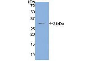 Detection of Recombinant DEP1, Human using Polyclonal Antibody to Density Enhanced Phosphatase 1 (DEP1) (PTPRJ 抗体  (AA 1061-1293))