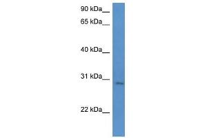 Western Blot showing UTP23 antibody used at a concentration of 1-2 ug/ml to detect its target protein.