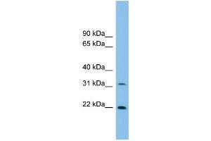 WB Suggested Anti-Foxn2 Antibody Titration: 0. (FOXN2 抗体  (N-Term))