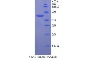 SDS-PAGE analysis of Mouse Centaurin alpha 2 Protein. (ADAP2 蛋白)