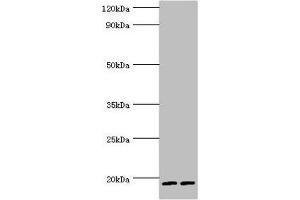 Western blot All lanes: Serglycin antibody at 9 μg/mL Lane 1: THP-1 whole cell lysate Lane 2: HL60 whole cell lysate Secondary Goat polyclonal to rabbit IgG at 1/10000 dilution Predicted band size: 18 kDa Observed band size: 18 kDa (SRGN 抗体  (AA 28-158))
