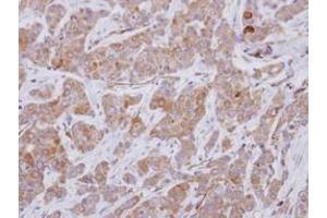 Image no. 2 for anti-Rho Guanine Nucleotide Exchange Factor 25 (ARHGEF25) (AA 226-446) antibody (ABIN1496711) (ARHGEF25/GEFT 抗体  (AA 226-446))