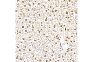 Immunohistochemistry of paraffin-embedded rat Intestine using MUC2 Rabbit pAb (ABIN7268690) at dilution of 1:300 (40x lens).
