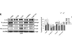 TEAD is involved in YAP1-induced EMT in A549 cells. (GAPDH 抗体)