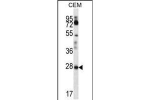 Western blot analysis in CEM cell line lysates (35ug/lane).