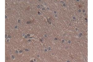 Immunohistochemistry (IHC) image for anti-Glycyl-tRNA Synthetase (GARS) (AA 567-735) antibody (ABIN7435301)