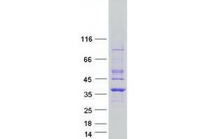 Pyrroline-5-Carboxylate Reductase 1 (PYCR1) (Transcript Variant 2) protein (Myc-DYKDDDDK Tag)
