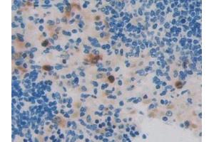 Detection of RNASE3 in Rat Spleen Tissue using Polyclonal Antibody to Ribonuclease A3 (RNASE3) (RNASE3 抗体  (AA 33-155))