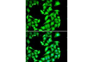 Immunofluorescence analysis of HeLa cells using PPM1A antibody. (PPM1A 抗体  (AA 1-382))