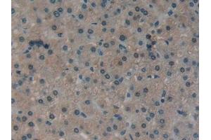 Detection of ATXN1 in Human Liver Tissue using Polyclonal Antibody to Ataxin 1 (ATXN1) (Ataxin 1 抗体  (AA 569-807))