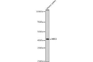 Western blot analysis of extracts of Mouse spleen, using NEIL1 antibody (ABIN6130579, ABIN6144514, ABIN6144515 and ABIN6221523) at 1:1000 dilution. (NEIL1 抗体  (AA 187-476))