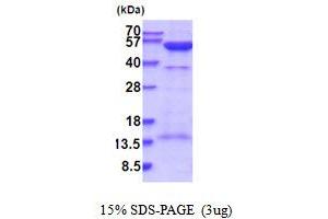 SDS-PAGE (SDS) image for Protein Kinase, CAMP-Dependent, Regulatory, Type II, alpha (PRKAR2A) (AA 1-404) protein (His tag) (ABIN5854185) (PRKAR2A Protein (AA 1-404) (His tag))