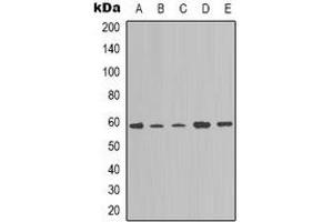Western blot analysis of NOTCH4 expression in A549 (A), K562 (B), Hela (C), mouse brain (D), NIH3T3 (E) whole cell lysates. (NOTCH4 抗体  (C-Term))