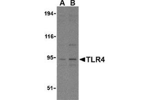 Western blot analysis of TLR4 in PC-3 cell lysates with this product at (A) 2. (TLR4 抗体  (N-Term))