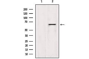 Western blot analysis of extracts from HepG2, using LGTN Antibody.