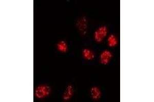 Immunofluorescent analysis of PPP3CA staining in Hela cells. (PPP3CA 抗体)