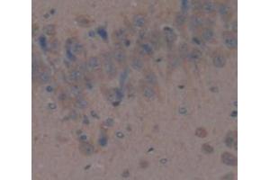 IHC-P analysis of Rat Tissue, with DAB staining. (DPP4 抗体  (AA 638-767))