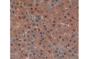 IHC-P analysis of liver tissue, with DAB staining. (EED 抗体  (AA 142-441))