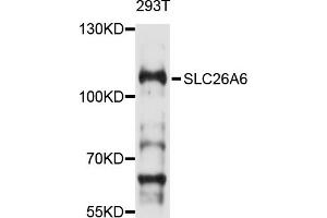 Western blot analysis of extracts of 293T cells, using SLC26A6 antibody (ABIN4905190) at 1:1000 dilution. (SLC26A6 抗体)