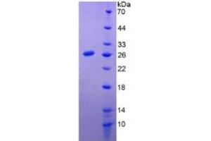 SDS-PAGE of Protein Standard from the Kit  (Highly purified E. (Prolactin ELISA 试剂盒)
