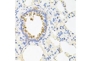 Immunohistochemistry of paraffin-embedded rat lung using NCR3 antibody (ABIN5974302) at dilution of 1/100 (40x lens). (NCR3 抗体)