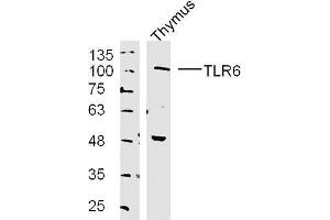 Mouse thymus lysates probed with TLR6 Polyclonal Antibody, unconjugated  at 1:300 overnight at 4°C followed by a conjugated secondary antibody at 1:10000 for 90 minutes at 37°C. (TLR6 抗体  (AA 301-400))