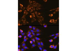 Immunofluorescence analysis of NIH-3T3 cells using Integrin-β1/CD29 Rabbit pAb (ABIN6134032, ABIN6142578, ABIN6142579 and ABIN6219452) at dilution of 1:100 (40x lens). (ITGB1 抗体  (AA 600-700))