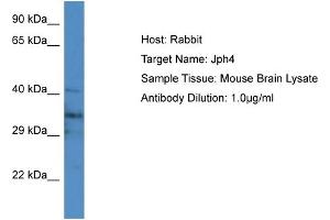 Host: Rabbit Target Name: Jph4 Sample Type: Mouse Brain lysates Antibody Dilution: 1. (Junctophilin 4 抗体  (Middle Region))