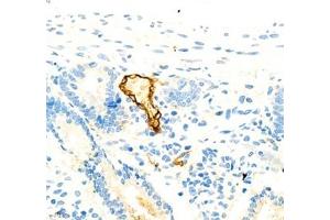 Immunohistochemistry (Paraffin-embedded Sections) (IHC (p)) image for anti-Mucosal Vascular Addressin Cell Adhesion Molecule 1 (MADCAM1) antibody (ABIN7074695)