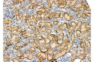 ABIN6265698 and ABIN6277586 at 1/100 staining Rat kidney tissue by IHC-P. (TPT1 抗体  (Internal Region))
