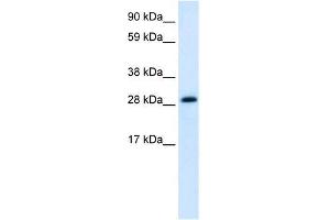 Human heart; WB Suggested Anti-ABT1 Antibody Titration: 1. (Activator of Basal Transcription 1 抗体  (Middle Region))