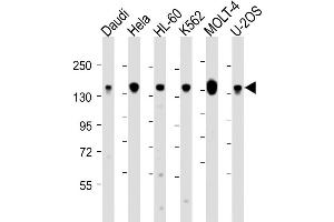 Western Blot at 1:2000 dilution Lane 1: Daudi whole cell lysate Lane 2: Hela whole cell lysate Lane 3: HL-60 whole cell lysate Lane 4: K562 whole cell lysate Lane 5: MOLT-4 whole cell lysate Lane 6: U-2OS whole cell lysate Lysates/proteins at 20 ug per lane. (THRAP3 抗体  (C-Term))