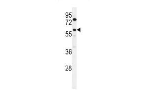 Western blot analysis of ACBG2 Antibody (Center) (ABIN653811 and ABIN2843086) in K562 cell line lysates (35 μg/lane). (ACSBG2 抗体  (AA 237-265))