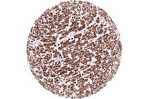 Heart muscle exhibiting a strong granular cytoplasmic SDHA staining (Recombinant SDHA 抗体  (N-Term))