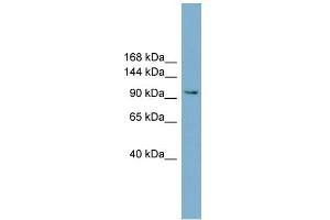 WB Suggested Anti-NCAM2 Antibody Titration:  0. (NCAM2 抗体  (Middle Region))