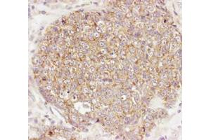 Immunohistochemistry. (AKT1 抗体  (C-Term))