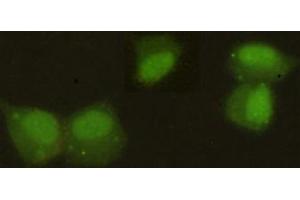 Immunocytochemistry stain of Hela using HP1 alpha mouse mAb (1:300). (CBX5 抗体)