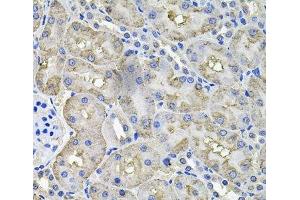 Immunohistochemistry of paraffin-embedded Rat kidney using ACO1 Polyclonal Antibody at dilution of 1:100 (40x lens). (Aconitase 1 抗体)