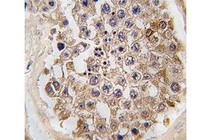IHC analysis of FFPE human testis tissue stained with mTOR antibody (MTOR 抗体  (AA 2459-2488))
