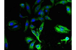 Immunofluorescent analysis of Hela cells using ABIN7171536 at dilution of 1:100 and Alexa Fluor 488-congugated AffiniPure Goat Anti-Rabbit IgG(H+L) (TAS2R13 抗体  (AA 150-184))