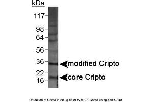 Image no. 1 for anti-Teratocarcinoma-Derived Growth Factor 1 (TDGF1) (N-Term) antibody (ABIN363493) (TDGF1 抗体  (N-Term))